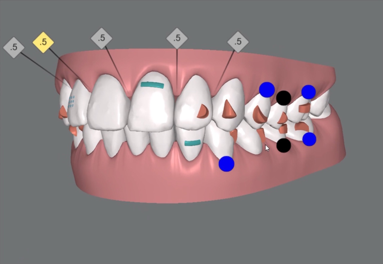 Orthodontics and clear aligners at FaceLab